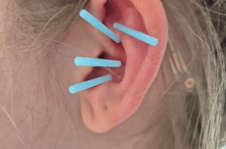 OptimaMed Wildbad implementiert NADA-Therapie